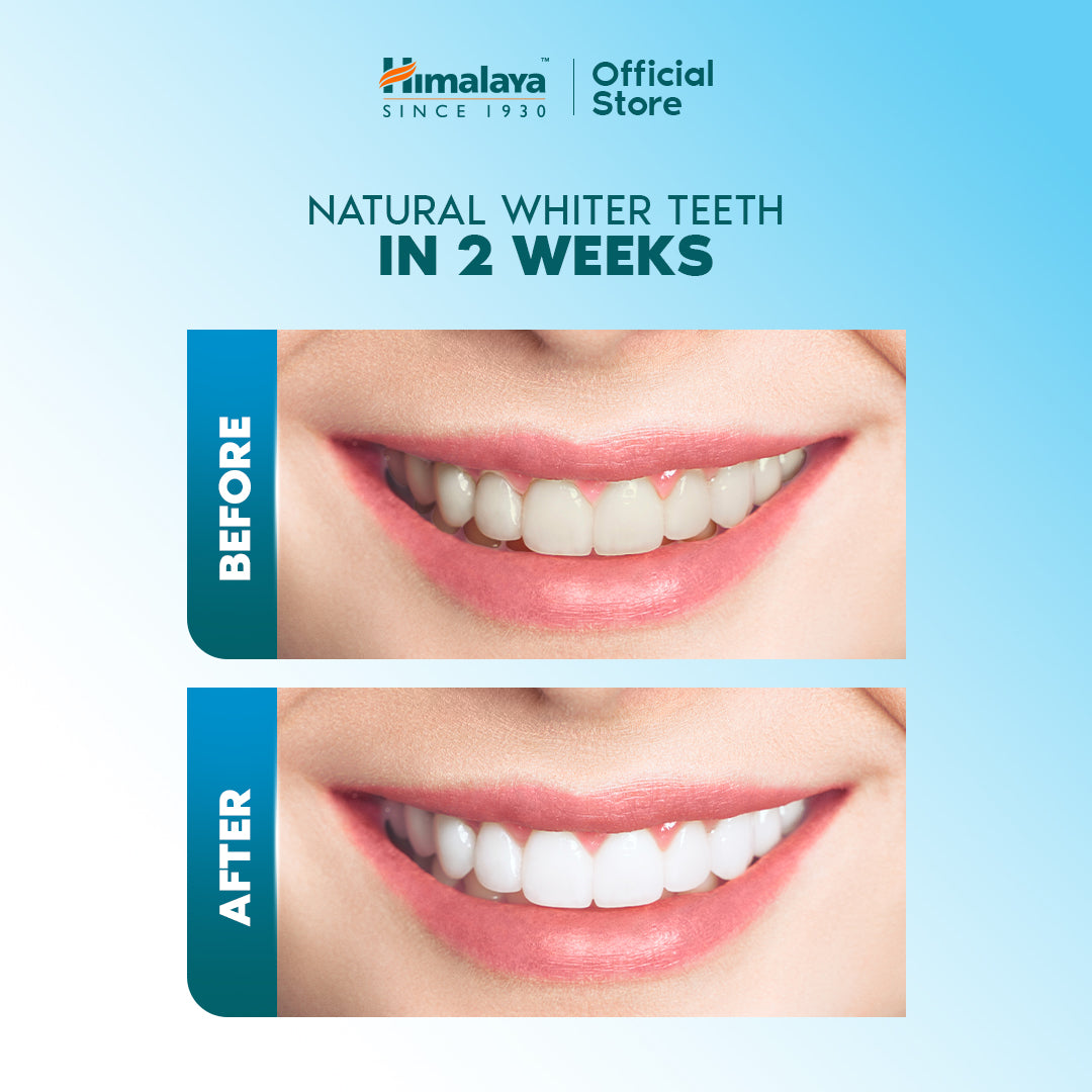 Himalaya Sparkling White Toothpaste