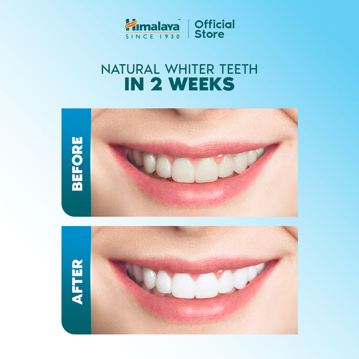 Himalaya Sparkling White Toothpaste